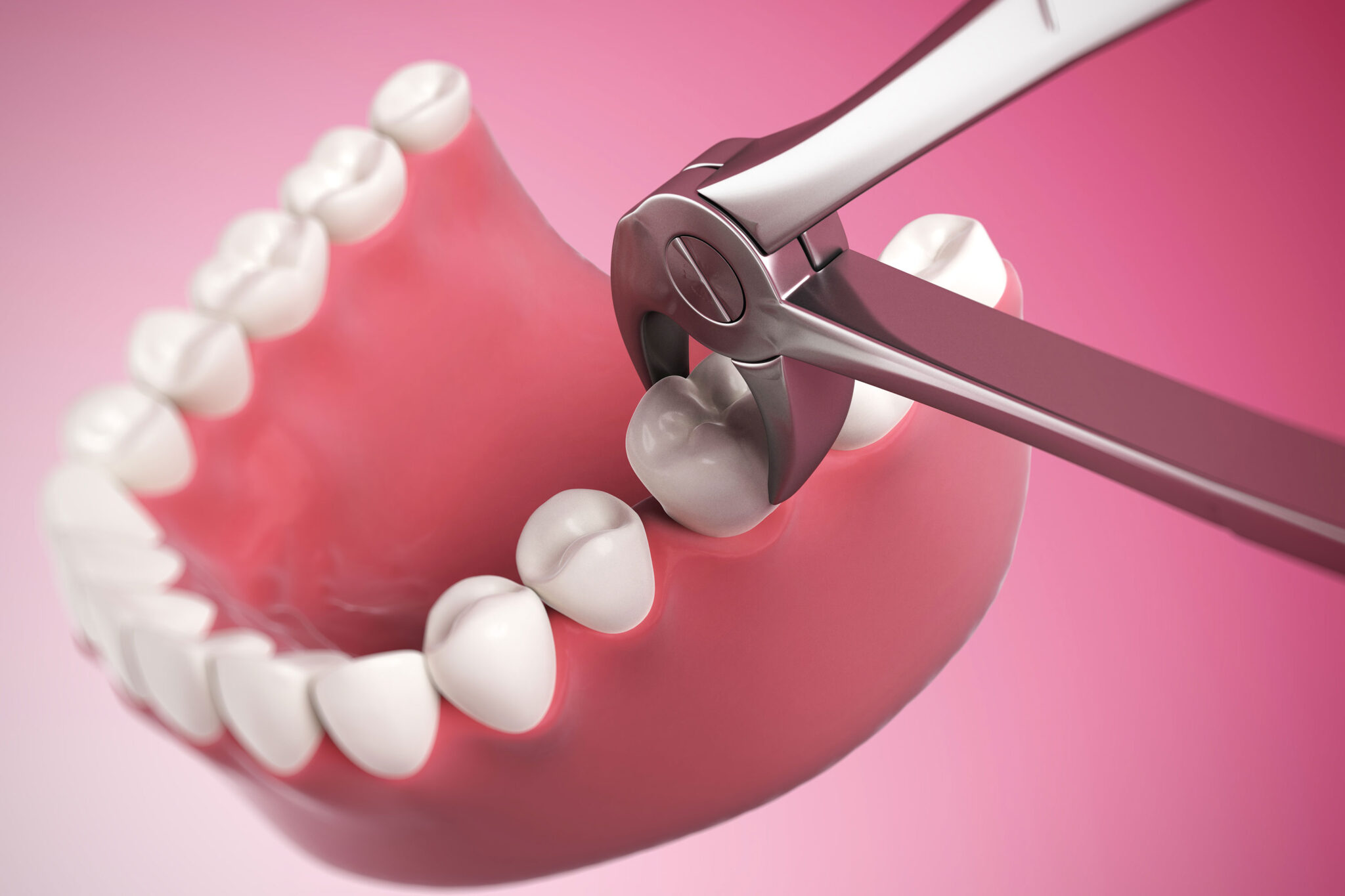 how-do-your-gums-heal-after-a-tooth-extraction